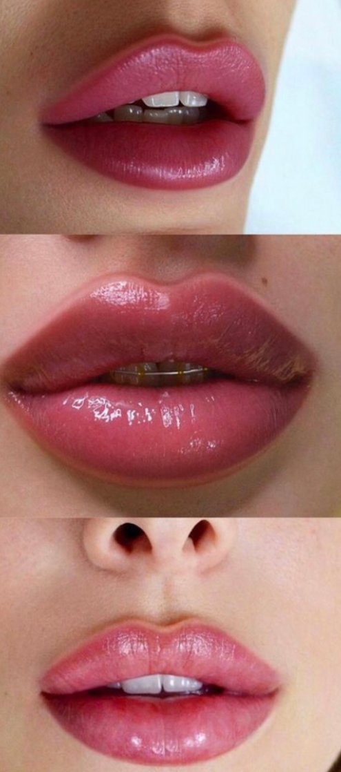FILLERS