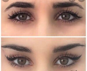 Foxy Eyes
